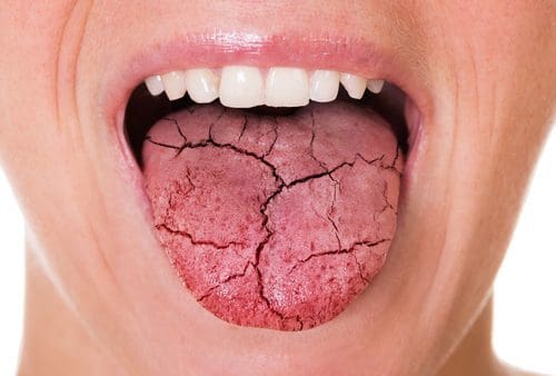 Warum Verursacht Cannabis Mundtrockenheit?